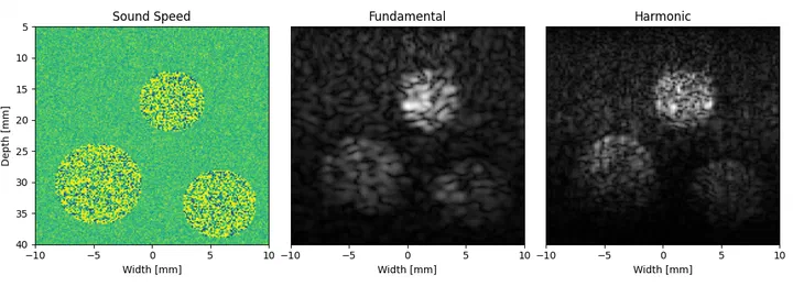 Reconstructed b-mode images