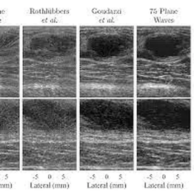 CUBDL: Challenge on Ultrasound Beamforming with Deep Learning