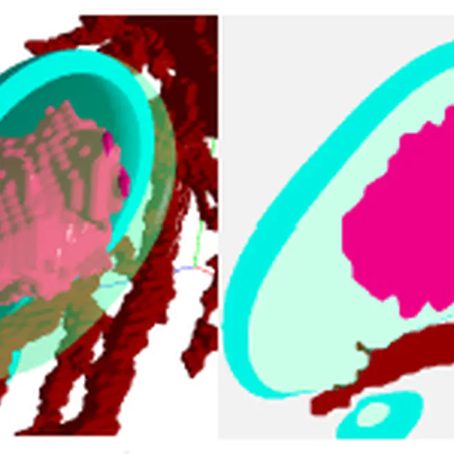 Studying the effect of tissue properties on radiofrequency ablation by visual simulation ensemble analysis