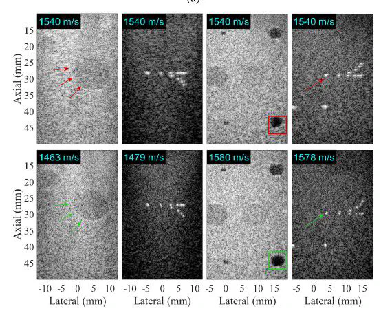 reference images for ultrasound beamforming