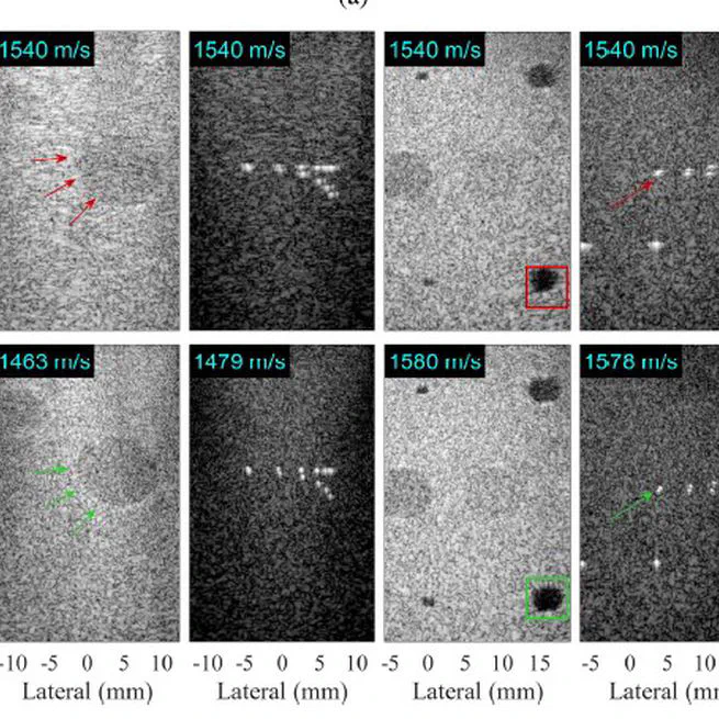 Deep learning for ultrasound image formation: CUBDL evaluation framework and open datasets