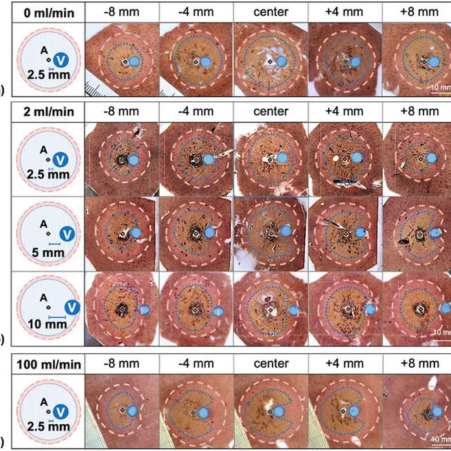 Three-dimensional assessment of vascular cooling effects on hepatic microwave ablation in a standardized ex vivo model