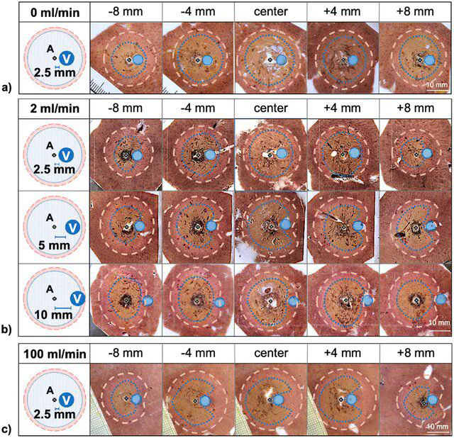 Tissue damage and cooling effects of vessels