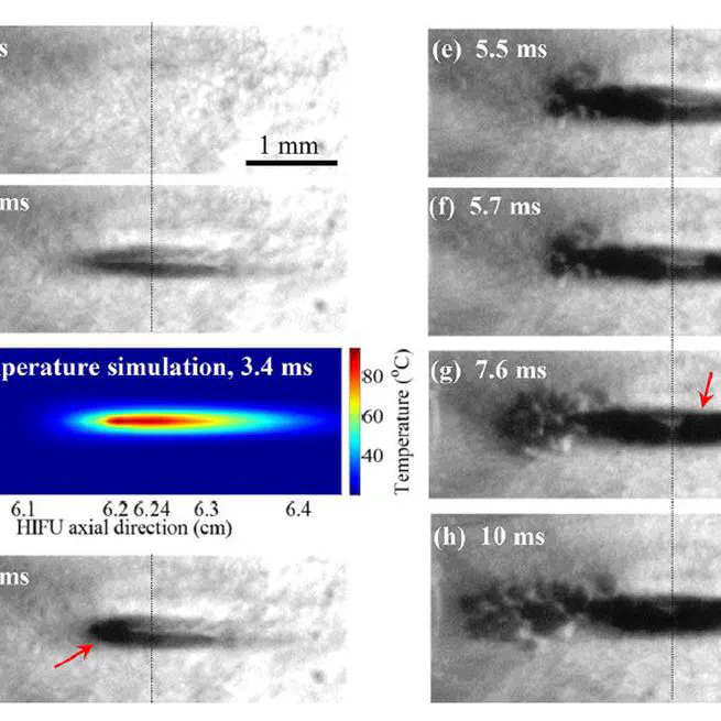 Numerical and experimental study of mechanisms involved in boiling histotripsy