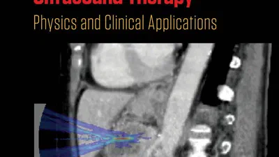 Numerical Modelling for Simulation and Planning of Focused Ultrasound Treatments featured image
