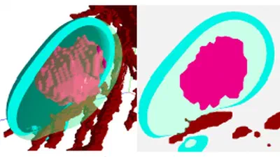 Studying the effect of tissue properties on radiofrequency ablation by visual simulation ensemble analysis featured image