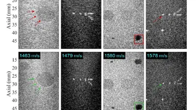 Deep learning for ultrasound image formation: CUBDL evaluation framework and open datasets featured image