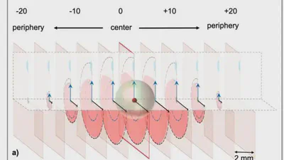 Optimizing Microwave Ablation planning with the Ablation Success Ratio featured image