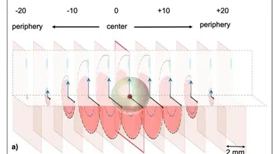 Optimizing microwave ablation planning with the ablation success ratio featured image