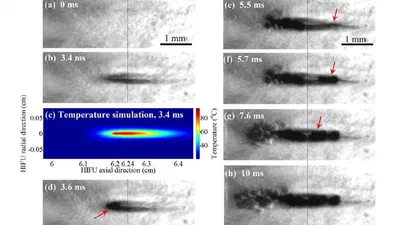 Numerical and experimental study of mechanisms involved in boiling histotripsy featured image