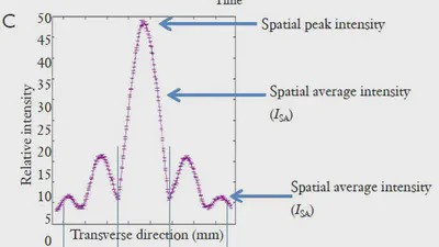 Dosimetry implications for correct ultrasound dose deposition: uncertainties in descriptors, planning and treatment delivery featured image