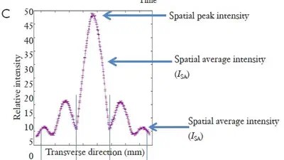 Dosimetry implications for correct ultrasound dose deposition: uncertainties in descriptors, planning and treatment delivery featured image